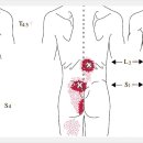 다열근과 회선근 연관통증[Multifidi and rotators Referral Pain] 이미지