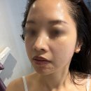 털털한언니쓰 | 포항 털털한언니쓰 여드름피부 포항마사지샵 추천(솔직후기)