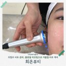 평화로 L | 의정부 에스테틱 희온뷰티 물방울 초음파, 건조함과 수분까지 꽉 잡은 솔직 후기