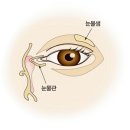 안구 건조증[Dry eye syndrome눈질환] 이미지