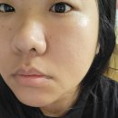 랩스비(LABS BE) | 뷰티디바이스 팔자주름없애기 신라면세점 입점 비랩스 사용 후기