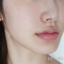 에이치바이옴 이미지