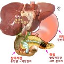 급체 위경련 원인과 치료 3가지 비결 이미지