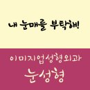 눈성형 / 눈성형가격 / 눈성형비용 / 눈성형후기 / 눈성형잘하는곳 / 눈성형유명한곳 / 눈성형전후 / 이미지업성형외과 이미지