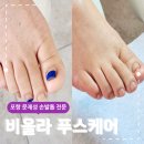 포항내성발톱 전문 관리샵 비올라 푸스케어 방문 후기