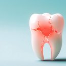 양플란트치과의원 이미지