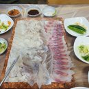 (주)성원메디칼 | 서면성형외과, 스트레스였던 눈밑을 해결해준 눈밑지방재배치