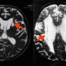강남구치매안심센터 이미지