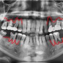 좌동로 93 이미지