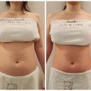 리하 | 부산 연산동 웨딩관리 복부관리 잘하는 리하에스테틱 다녀온 후기