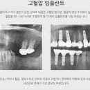 나의미소치과의원 네이버블로그
