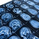 메디캐치의원 이미지