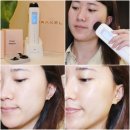 디엔에이의료기기 | 뷰티 디바이스 피부재생 레이저 퓨라셀미 홈케어 간편해