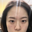 개예쁨주의 | 인생 첫 피부시술 후기 “예쁨주의 쁨 의원” 스킨보톡스/물광주사/턱보톡스/윤곽주사