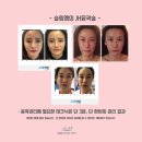 체형관리JH