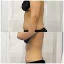 빛나리자 이미지