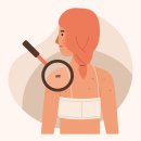 채항외과의원 | [태리의 일상] 피지 낭종? 표피 낭종? 수술 후기(feat. 영통항외과)