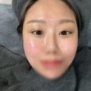 응구 | 안양피부샵 자려한에스테틱에서 피부관리 내돈내산 후기