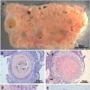 Archamoeba Endolimax carassius감염 금붕어 신장 육아종증 이미지