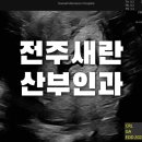 전주위앤장내과의원 | [임신육아] 전주새란산부인과에서 한나로 전원후기