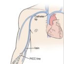 천안충무병원 | 30대 뇌경색 입원일기 (+PICC,식도경유심장초음파 후기) 천안 충무병원