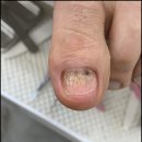 미엘네일 이미지