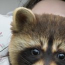 소원주유소 | 담소유 부유방 유선조직 제거 수술 후기 01. 당일 퇴원