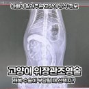 연동제 | 고양이 이물질 섭취, 탐색적 개복술 수술 전 위장관 조영술 후기
