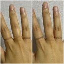 주식회사 힐스밤 | 힐스밤 몸숨다이어트 3일 성공 후기