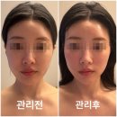 청주신부관리 유명한 아름하다에서 얼굴경락 효과본 후기