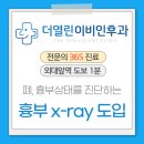 이문동 더열린이비인후과, chest 엑스레이 도입 안내