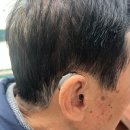 독일보청기 태평센터 이미지