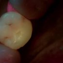 열린오치과의원 이미지