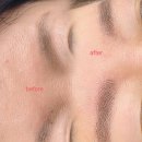 “피부 데미지 걱정 끝! 최상의 자연눈썹 헤어스트록으로 완성” – 천안 반영구 헤어스트록 후기