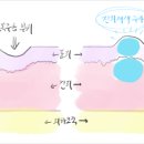 목주름시술비용? 찾아도 소용없는 이유