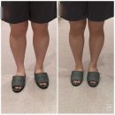 운현공원 | 강남다이어트한의원 월화수 감비환 비대면처방으로 디톡탕도 같이