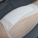 우신약국 | 종아리 붓기빼는 법 근육통 발바닥 통증까지 케어하는 아르니패치 사용 후기