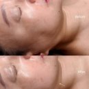경전철 의정부역 | [의정부] 의정부 피부관리 받고 얼굴선 달라졌다 트루에스테틱 솔직 후기