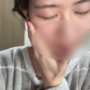 예약국 | 약대생의 약국 전용 PDRN 크림 리쥬비더마 후기!