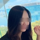 서울퍼스트성형외과의원 | 얼굴 돌출점 코 튀어나온 점 제거 수술 신사역 팩트성형외과