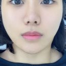 앵두미인 | [광교입술문신] 흐릿한 입술 라인 완벽 교정! 리위뷰티룸 입술 반영구 1, 2차 찐 후기 💋