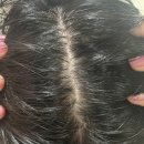 성동게임랜드 | [성수동미용실] 두피간지러움, 각질, 뾰루지, 노폐물 관리하고 싶다면 성수 미용실 샵위드 성수본점...