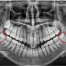 송탄바른치과의원 이미지