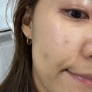 (주)이디젤 | [클렌징 젤 추천] 보습력 좋은 '제로이드 더마뉴얼 클렌징 젤'