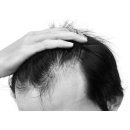 헤어뉴(HAIR NEW) 이미지
