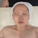 아로마피부관리 | [청라에스테틱] 뷰티팬지에스테틱에서 아로마 피부 여드름관리 솔직 후기