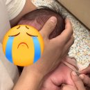 차의과대학교 부속 구미차병원 | 신생아 BCG 예방 접종 피내용 경피용 차이 차병원 예약 접종 후기