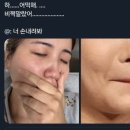 빙빙