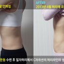 바른자세척추운동 이미지