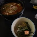 소망안과의원 | 서울 여의도 라섹 병원 솔직후기 제이씨빛소망안과, 통증과 회복과정 렌즈제거